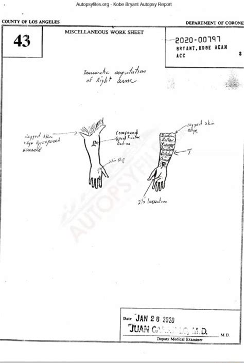 kobes autopsy|Autopsyfiles.org